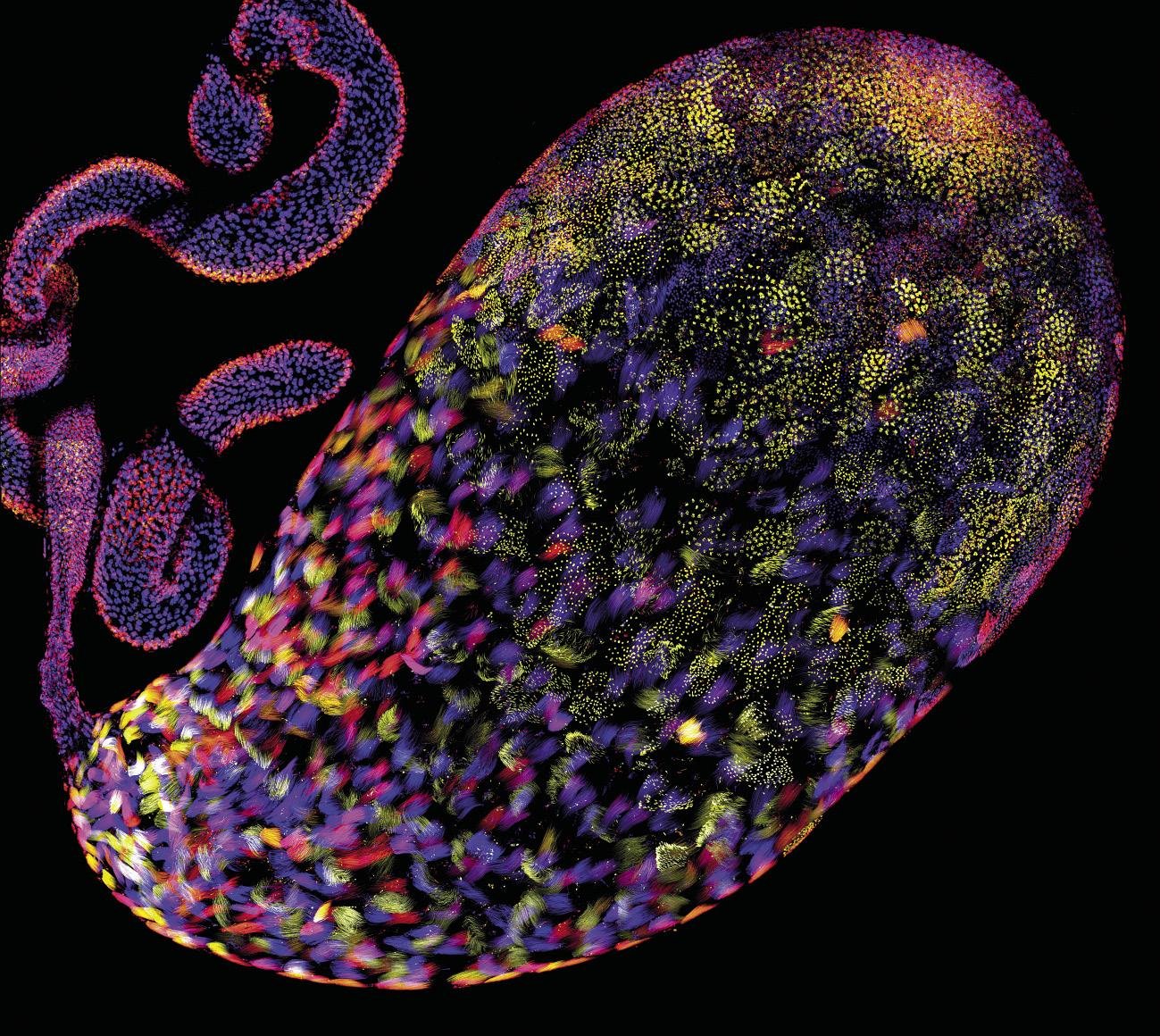 Espermaren garapena ozpin-euliaren testikuluan