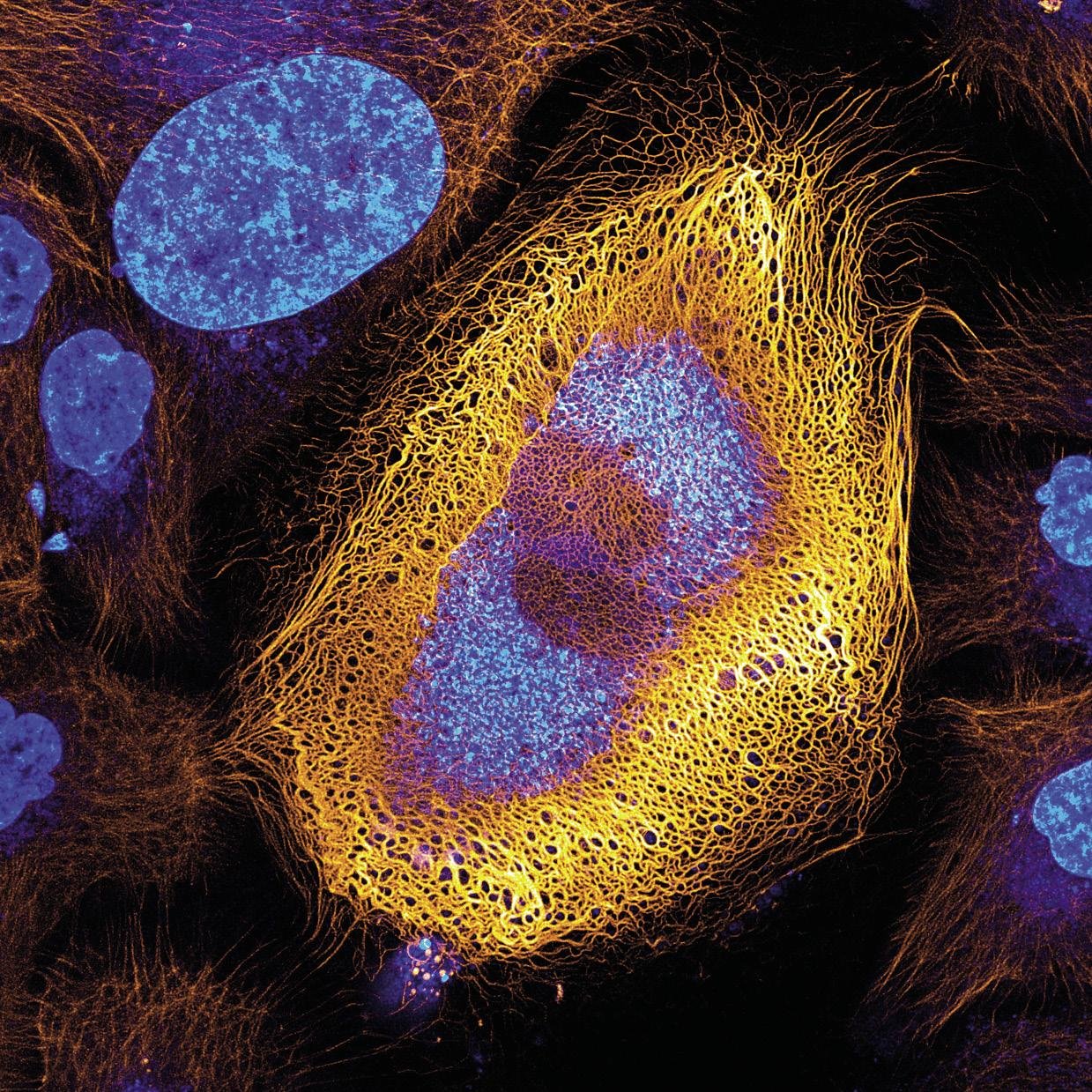 Giza azalaren zelula bat, fluoreszentziaz markatutako keratina espresatzen