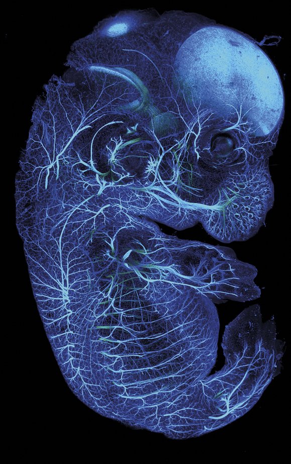 Hamahiru eguneko sagu-enbrioi bat gardendua, nerbi
