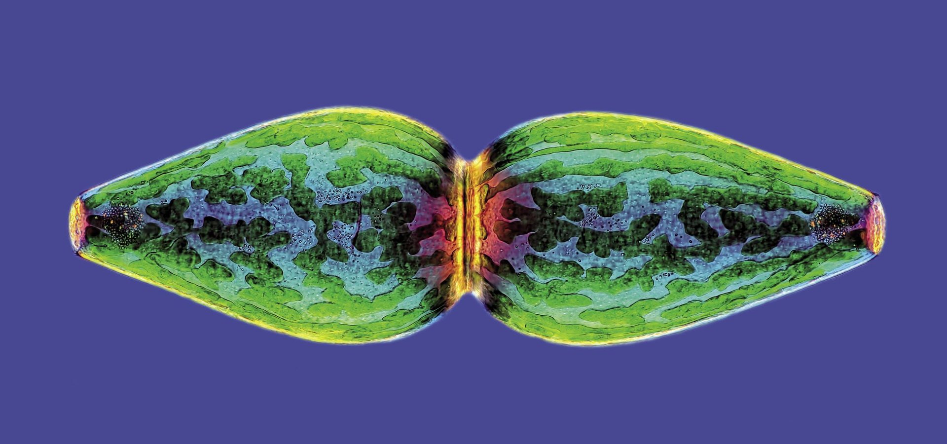 Pleurotaenium ovatum microalga (x40)