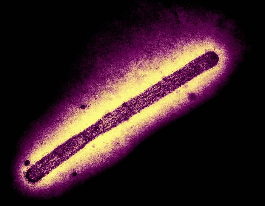 h5n1-birusak-hainbat-mutazio-behar-ditu-gizakietan