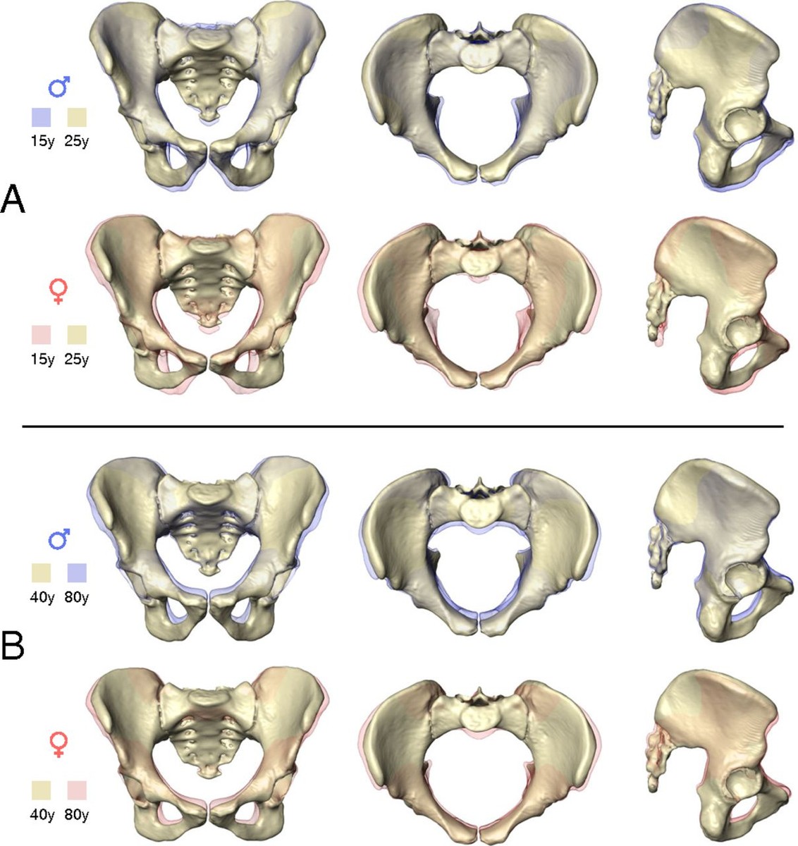 tipos de pelvis