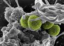 Bakterio erresistenteen birulentzia handitzen duen gene bat aurkitu dute
