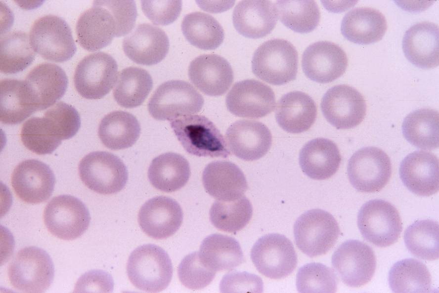 malariari-aurre-egiteko-lehen-hesi-immunitarioa-id