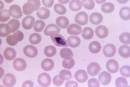 Malariari aurre egiteko lehen hesi immunitarioa identifikatu dute