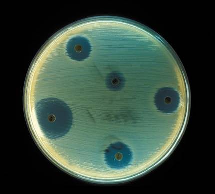 bakterio-erresistenteei-aurre-egiteko-plana-aurkez